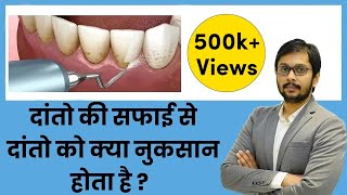 क्या दांतों की सफाई दांतों को नुकसान पहुंचाती है Does CleaningSCALING damage teeth by Dr Ankit [upl. by Rese]