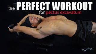 The Perfect Workout Routine to Improve Pectus Excavatum [upl. by Calli]