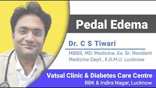 Know About Pedal Edema Causes Symptoms amp Treatment By MD Medicine Dr C S Tiwari [upl. by Giff]