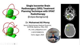 Single Isocenter Brain Radiosurgery SRS Treatment Planning Technique with VMAT Radiotherapy [upl. by Olmstead]