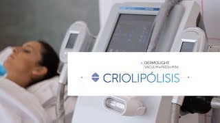 Criolipólisis Sveltia Dermolight Vacuum [upl. by Rhines]