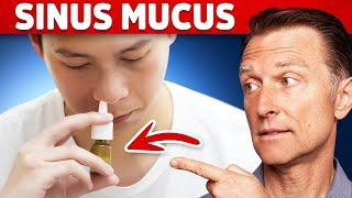 The 1 Remedy for Sinus Mucus  Pressure  Postnasal Drip [upl. by Thant]