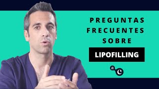 Lipofilling por Dr Alexo Carballeira [upl. by Aylad]