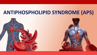 Antiphospholipid Syndrome APS  What Is APS and how to Manage It during Pregnancy [upl. by Berenice694]