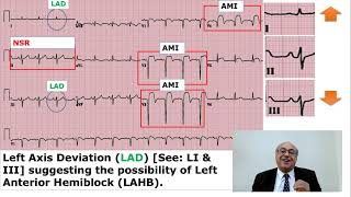 EKG Trainer Case 1 Answer internalmedicine cme usmle محاضراتباطنة ecg [upl. by Ricardo31]