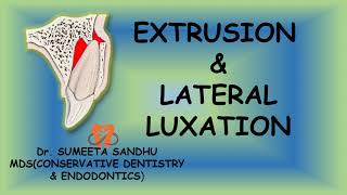 Extrusion and lateral luxation of teeth  Management Luxation injuries [upl. by Shoshana]