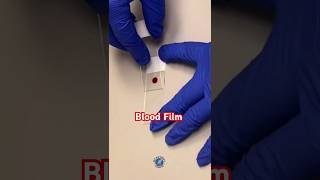 🪔🥰🥳Blood Film🩸🎉🪔 Shorts ShortsViralTV shorts shortsviral shortsvideo medical [upl. by Odnalor913]