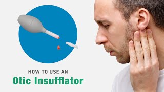 How to use an Otomed otic or ear insufflator device [upl. by Callista]