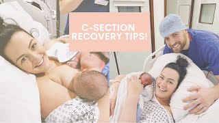 C Section Scar Recovery [upl. by Kennard]