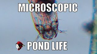 Microscopic Pond Life  Biodiversity Shorts 10 [upl. by Cooe665]