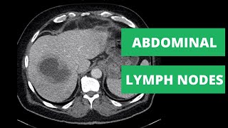 Abdominal CT Lymph Node Stations  How to read a CT [upl. by Haisoj]