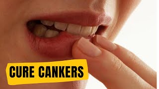 Lysine Toothpaste and the Wim Hof Method  How I Cured my Canker Sores [upl. by Caton]