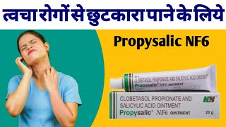 Propsaslic NF6 Ointment Uses Benefits And Side Effects In hindi  Clobetasol Propionate Cream [upl. by Brenda653]