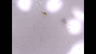 Copepods under a 200x Microscope [upl. by Jarita145]