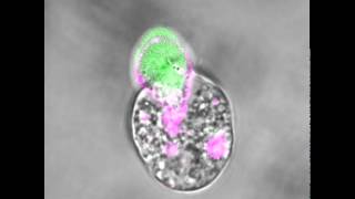 An amoeba eating a human cell [upl. by Iey]