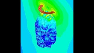 Ansys HFSS Tutorial SAR for Wireless Charging [upl. by Elna679]