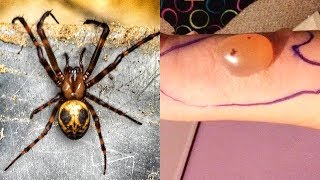 MOST Venomous Spiders On Earth [upl. by Martella]