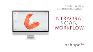 3Shape TRIOS Edentulous patient  Intraoral scan workflow [upl. by Sihunn]