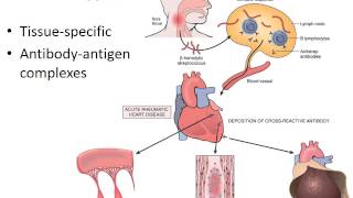 Hypersensitivity amp autoimmune diseases PART 1of2 Recorded Lecture [upl. by Cataldo]