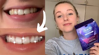 Oral B 3D White Whitestrips  Results Sensitivity [upl. by Ycaj]