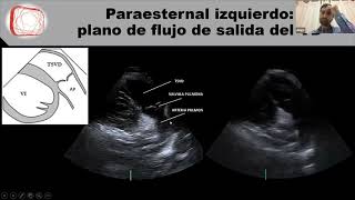 Clase 1 El ecocardiograma normal Dr Freytes [upl. by Bilow]