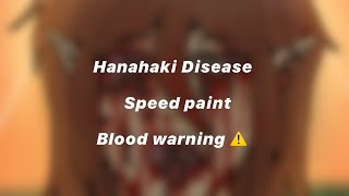 Hanahaki Disease 🌸 [upl. by Peck]