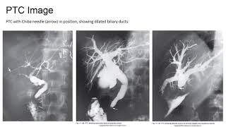 Anatomy and Radiographic Procedures of the Liver and Biliary System [upl. by Alana]