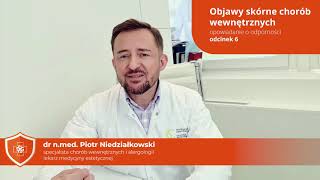 Objawy skórne chorób wewnętrznych  odcinek 6 [upl. by Heim]