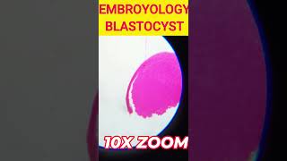 Embroyology Blastocyst cbsebiology icsebiology microscopy blastocyst microscopeworld [upl. by Karlotte]