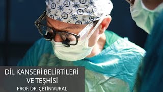 Dil Kanseri Belirtileri ve Teşhisi  Prof Dr Çetin Vural [upl. by Esihcoc]