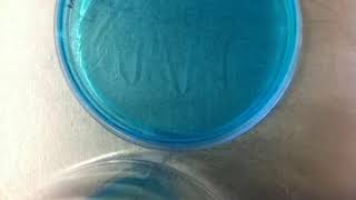 microbial growth  timelapse video [upl. by Ojiram253]