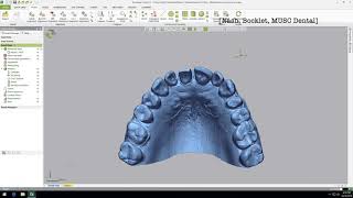 Dental Application of Geomagic Control X [upl. by Ahsina211]