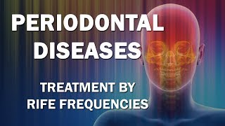 Periodontal Diseases  RIFE Frequencies Treatment  Energy amp Quantum Medicine with Bioresonance [upl. by Arlyn]