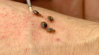 Meet the Bed Bug [upl. by Rachelle]