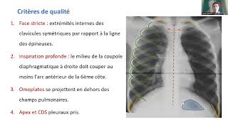 Radiographie thoracique [upl. by Tuhn244]