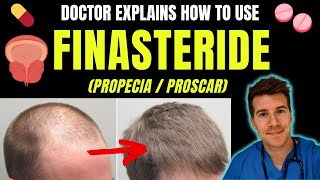 How to use FINASTERIDE propecia for BPH  hair loss including doses side effects amp more [upl. by Brock63]