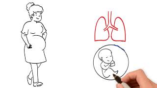 Pregnancy and the Respiratory System [upl. by Cyprian]