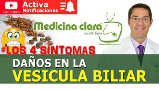 👨‍⚕️👀 LOS 4 SINTOMAS ALARMA VESÍCULA BILIAR DAÑADA PIEDRAS  Medicina Clara [upl. by Cavil760]