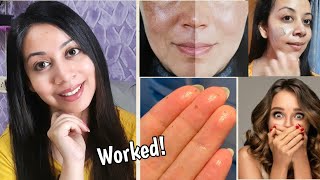 😳VIRAL But Easy Skincare Hacks That Work [upl. by Trubow803]