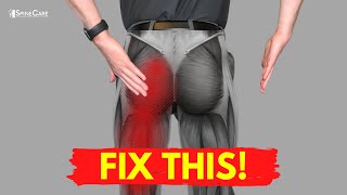 The QUICKEST Way to Get Sciatic Leg Pain Relief [upl. by Eneles]