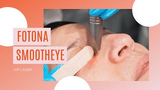 How to Get Rid of Under Eye Bags and Wrinkles  VIP Laser [upl. by Lanta]