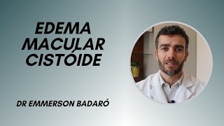 Edema macular cistóide  Dr Emmerson Badaró [upl. by Anilad532]