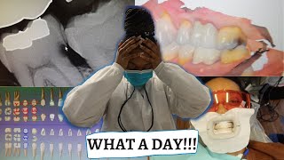 Should You Become A Dental Hygienist job description information etc [upl. by Rube664]