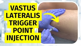 Trigger Point Injection Vastus Lateralis Technique [upl. by Pulsifer]