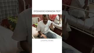 DYSDIADOCHOKINESIA TEST POSITIVE [upl. by Acirfa]