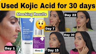 Used Derma co Kojic acid face wash and serum for 30 days 😳 Shocking Results 😨 [upl. by Brade162]