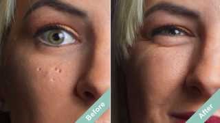 How to Cover Acne Scars with a Hollywood Secret [upl. by Amoihc]