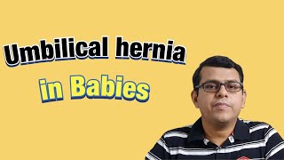 Umbilical Hernia in Babies [upl. by Vevay]