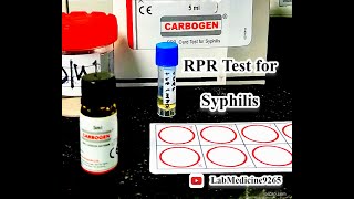 Rapid Plasma Reagin RPR Test  Serology  tulipdiagnosticspvtltdgoa [upl. by Dnomar]