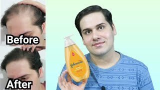 I tried Baby Shampoo for a year [upl. by Kristos]